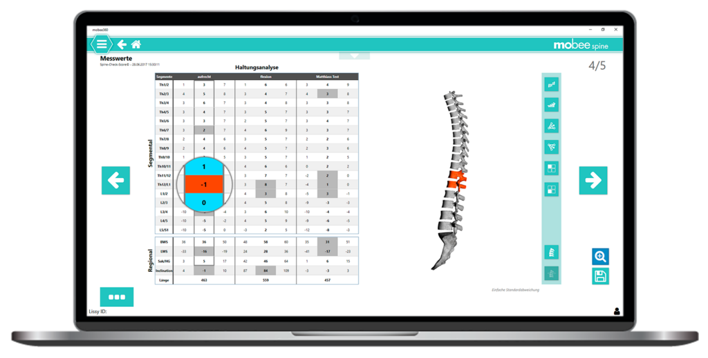 mobee spine Rückenanalyse Auswertung